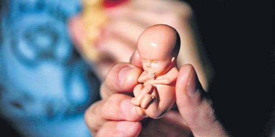 भ्रुण हत्या बढ्दै,  लिङ्ग पहिचानको असर जनगणनामा 