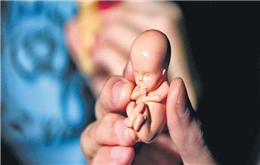 भ्रुण हत्या बढ्दै,  लिङ्ग पहिचानको असर जनगणनामा 